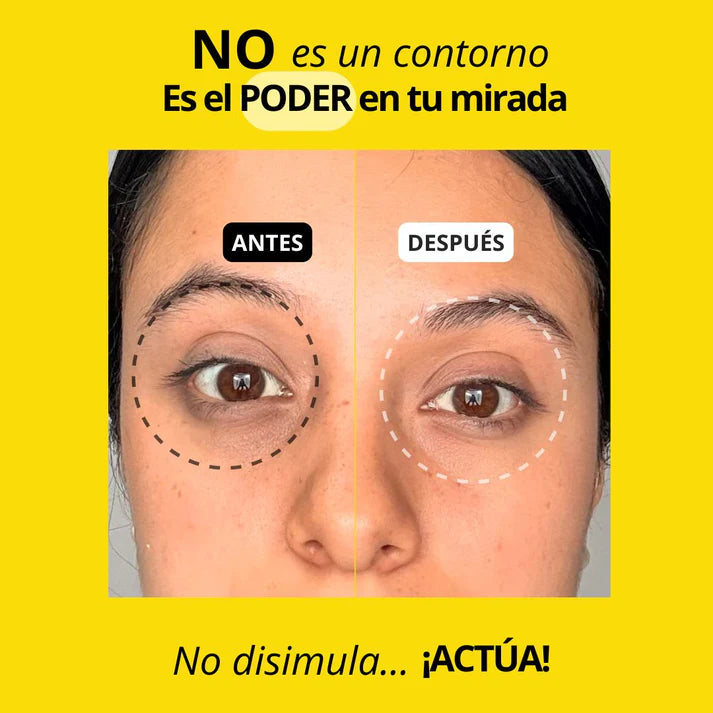 Bye Age Banana - Contorno Anti-Ojeras 12g